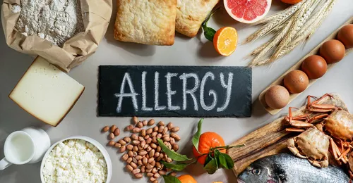 Alergias e intolerancias alimenticias
